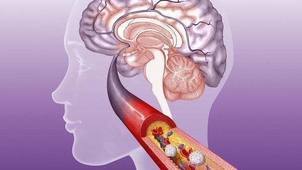 3種食物經常吃，可能會使血管變脆變硬，請你�嘴下留情�