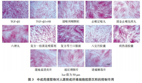 复方芩兰口服液对新冠肺炎肺纤维化具有抑制作用