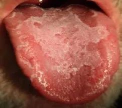 脱皮的病因不止干燥和洗衣粉，真菌和寄生虫才是更可怕的问题