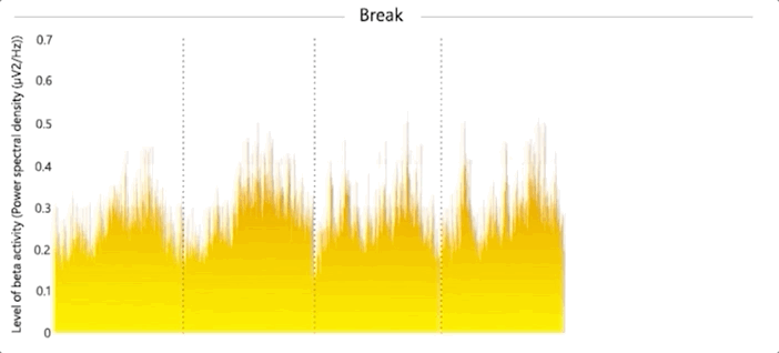 微软看了打工人的脑电波，难怪视频会议总犯困！斯坦福：女性尤甚
