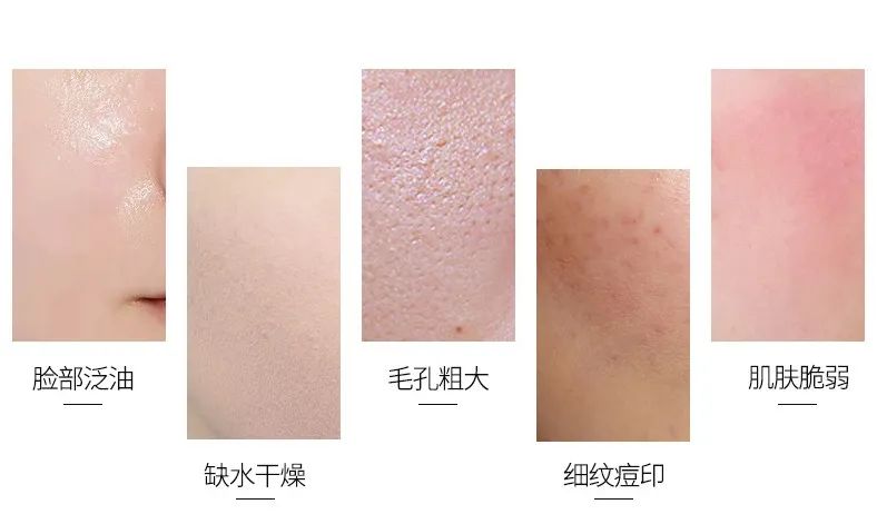 护肤秘籍 丨国庆“出游”不“出油”