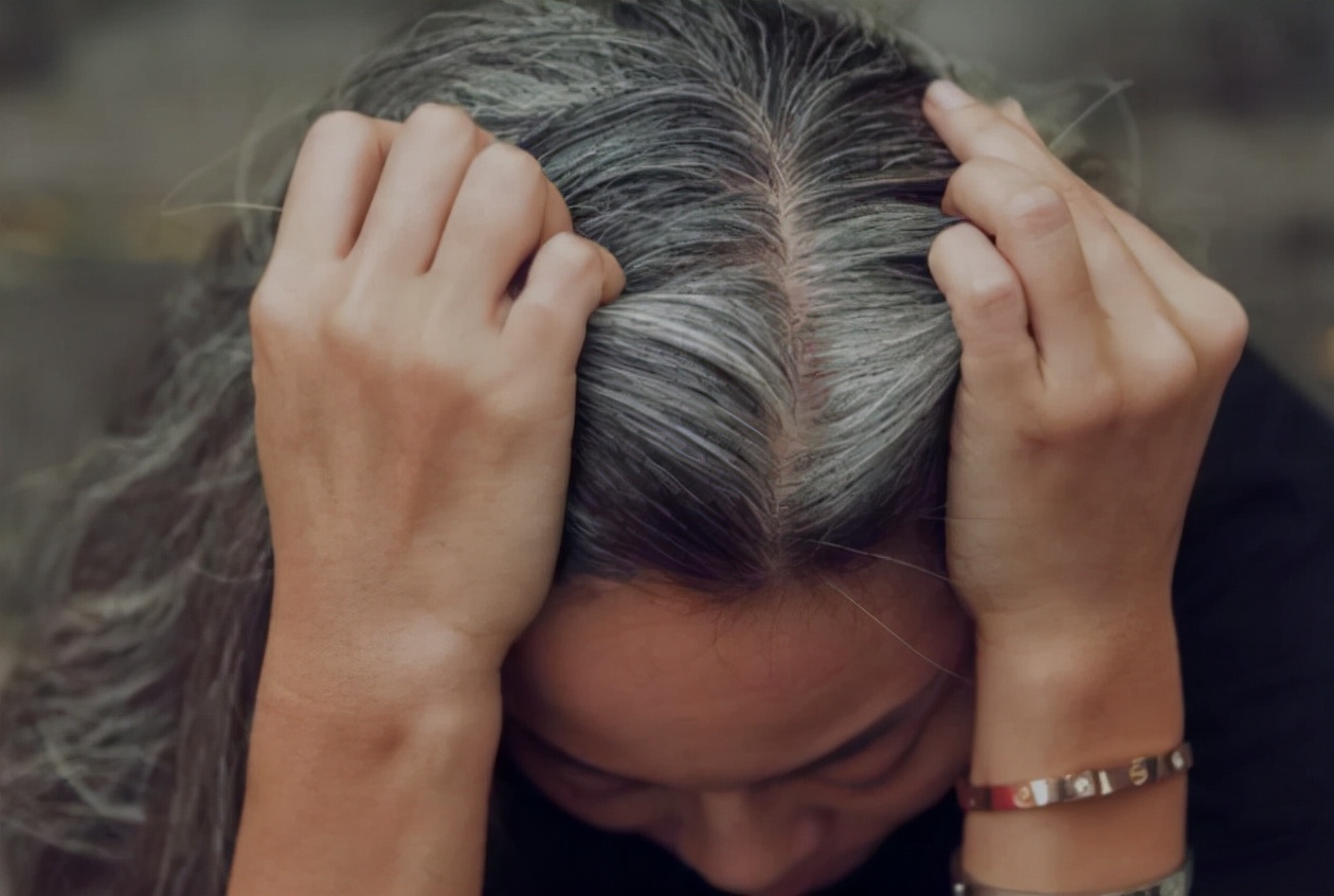 why-does-white-hair-grow-on-the-forehead-temples-and-back-of-the-head