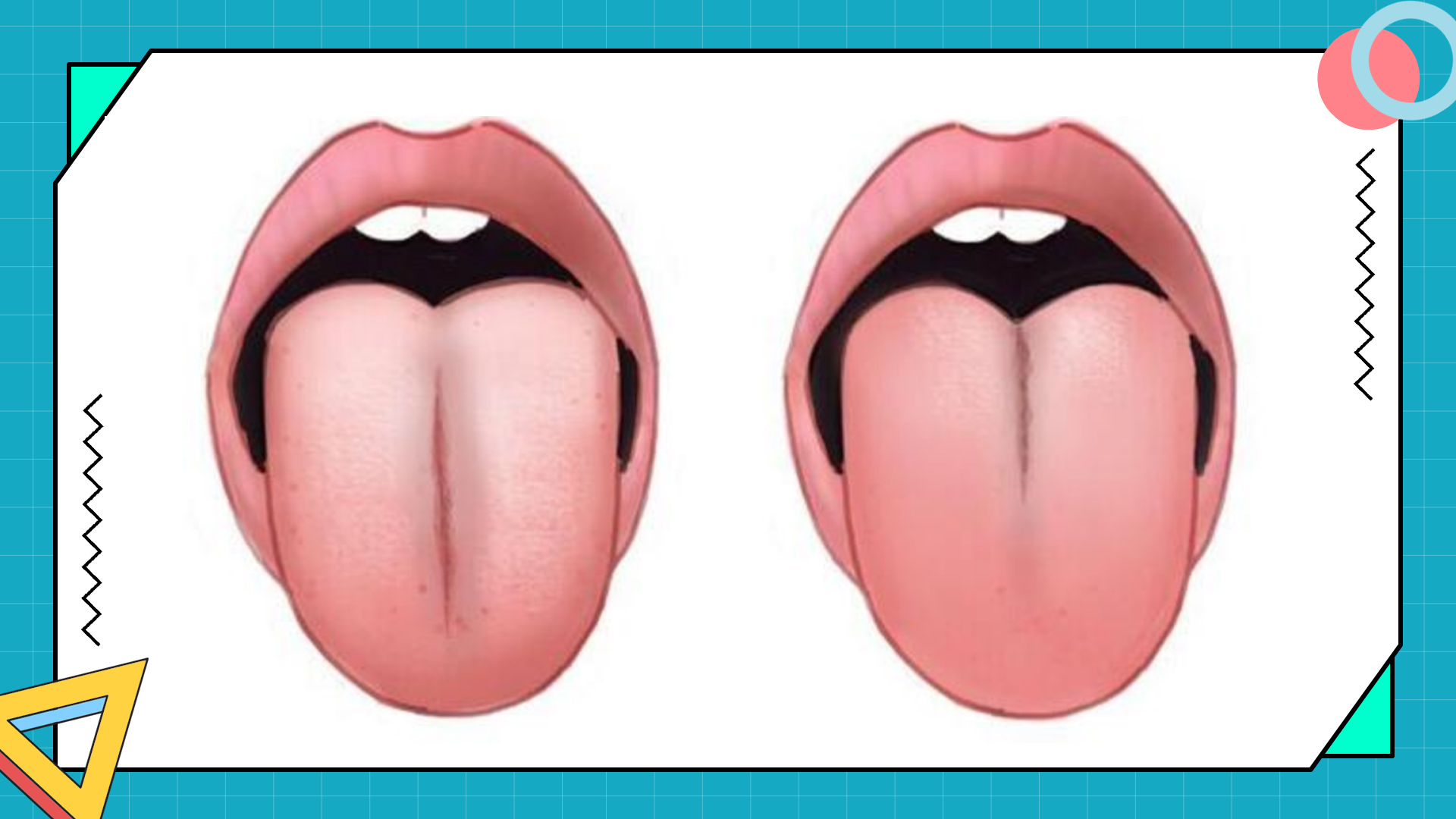 舌頭有裂紋，主要是這6個原因造成的，中醫6個小方可以治療