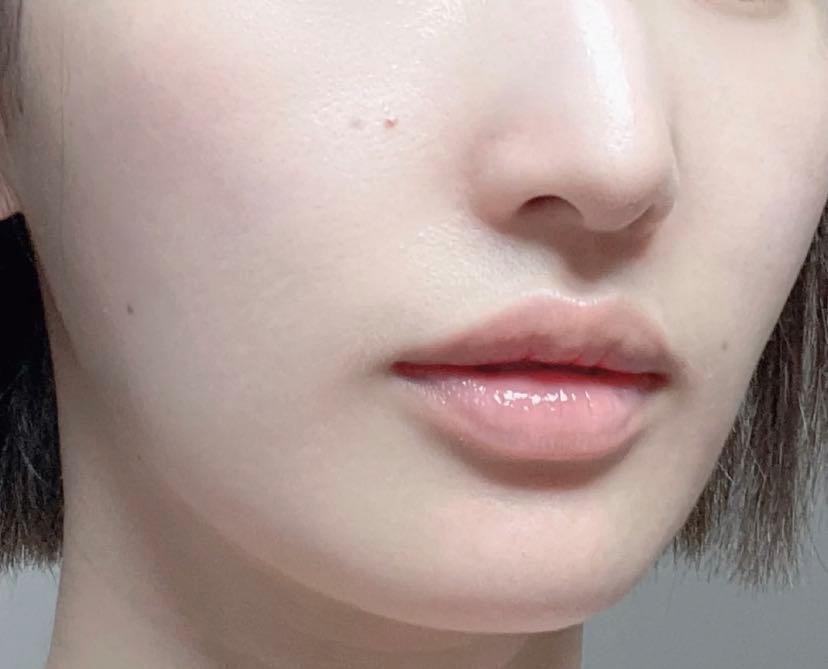 "Yellow face woman" with poor pregnant skin comes to her door?Deserve