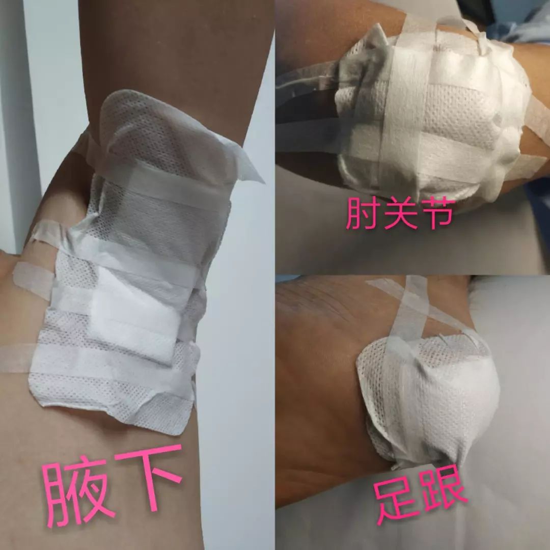 特殊部位的敷料粘贴法，护士患者都该学学！