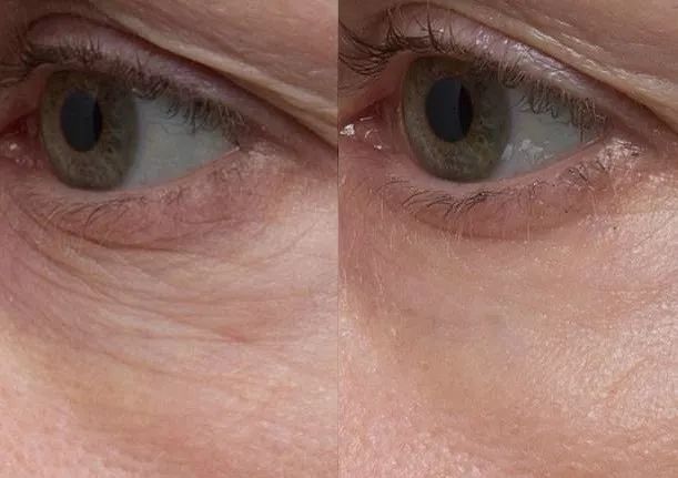 比许晴还撩的尤物，让3千万男人一夜失恋，看到