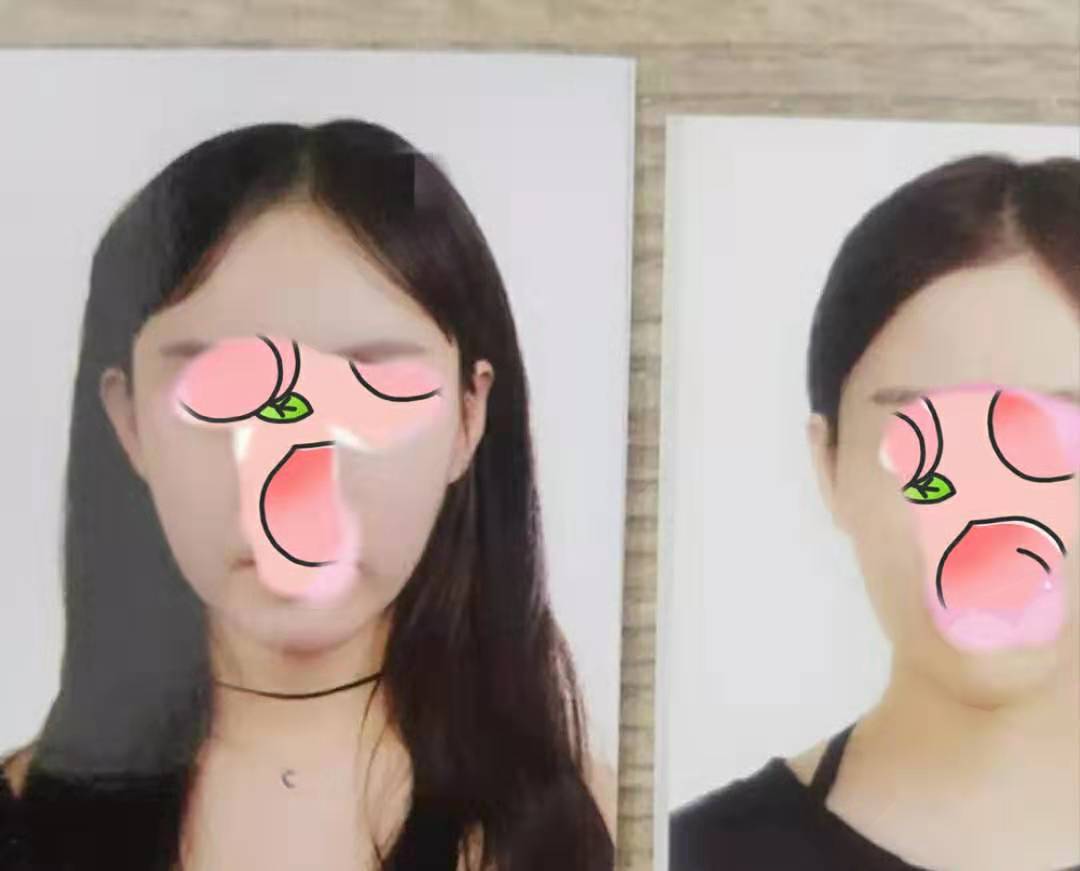「深度」中国女孩韩国整形“踩坑”始末：医美平台要背负多少责任？