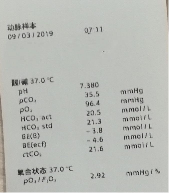 处于吸氧状态,po2正常,pco2 50mmhg,此时看氧合指数po2/pio2=292 300
