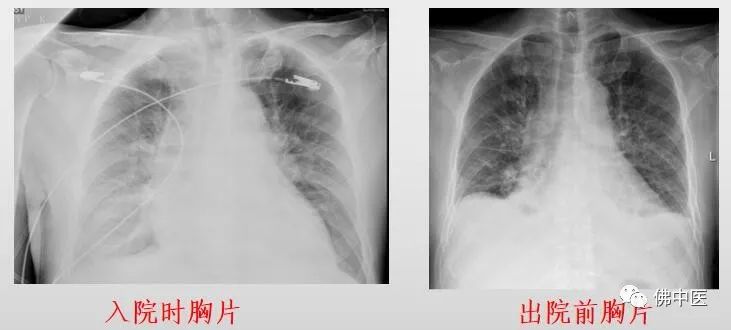 【医师节】肖秋生：让中医药在重症救治中发挥奇效