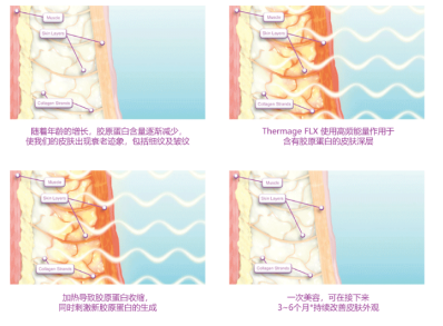 医美行业水有多深？平均2万元一次的贵妇级医美项目热玛吉 仪器不到3万元