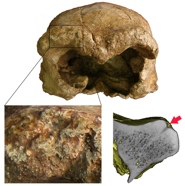 和縣直立人頭骨表麵痕跡揭示埋藏環境與生存活動