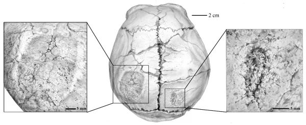 和縣直立人頭骨表麵痕跡揭示埋藏環境與生存活動