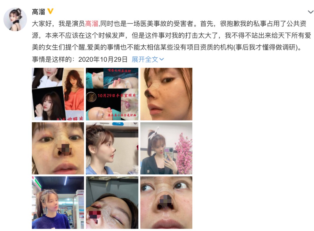 女演员突然自曝！整容失败