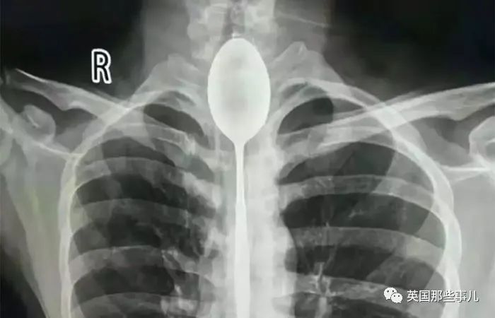 石棺裏藏貓貓，畫下還有另一副畫…X光下的各種物體原來這麽奇妙