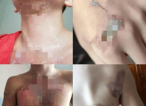 Bristle with anger making a person! 5 young athletes meet with teammate ride roughshod over