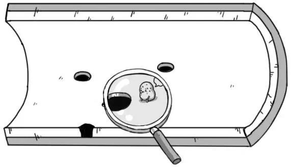 你的血管，就是這樣堵的