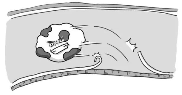 你的血管，就是這樣堵的