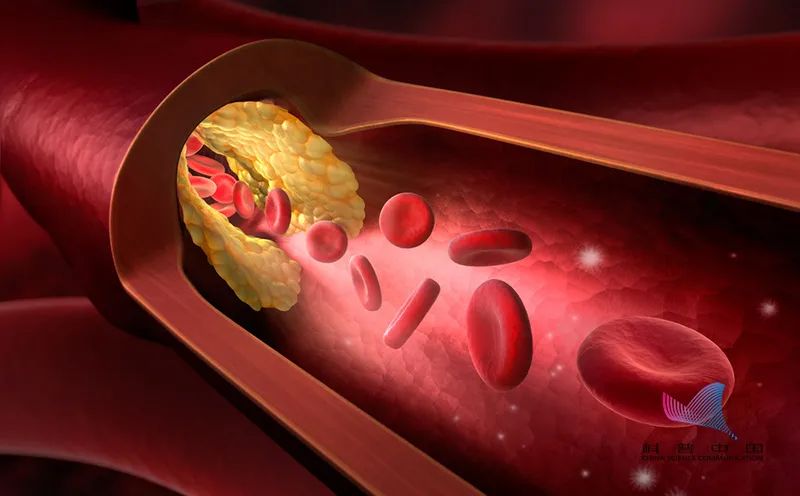 降壓藥早上吃最好，還是晚上最好？ 需要終身服用？ 你知道的可能都是錯的