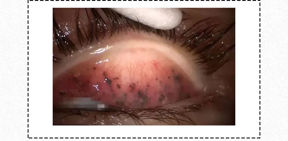 漫畫科普：“吹一吹，揉一揉”，這樣的動作別再做了！