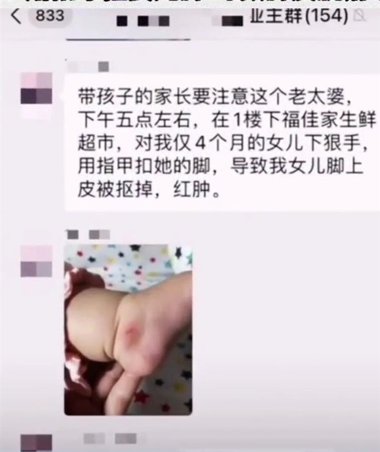 下手真狠！厦门大妈逛超市抠掉女婴脚皮，律师称属故意伤害，警方介入调查