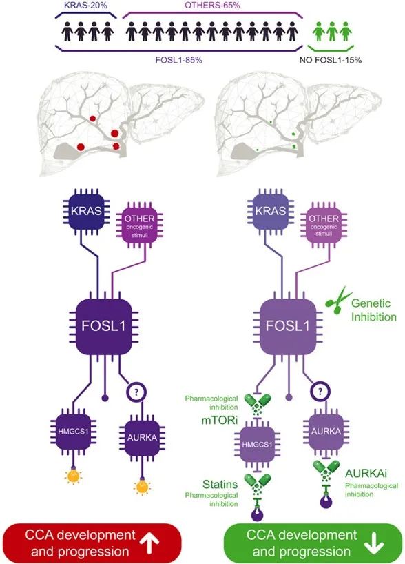 FOSL1及其下游转录效应因子在胆管癌发生发展中的作用