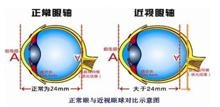 兒童近視眼鏡避坑指南:我用親身經歷的配鏡經歷來告訴你們