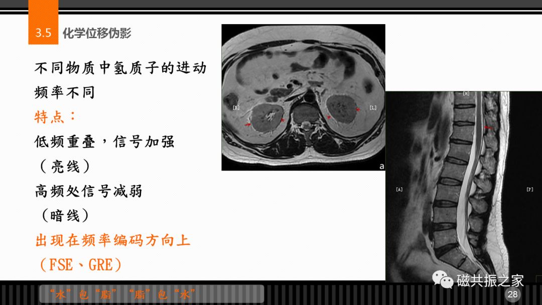 磁共振常见伪影及策略