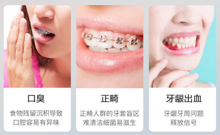 洁牙方式升级，英普利弹冲水流冲牙器五边形战士款上手轻体验