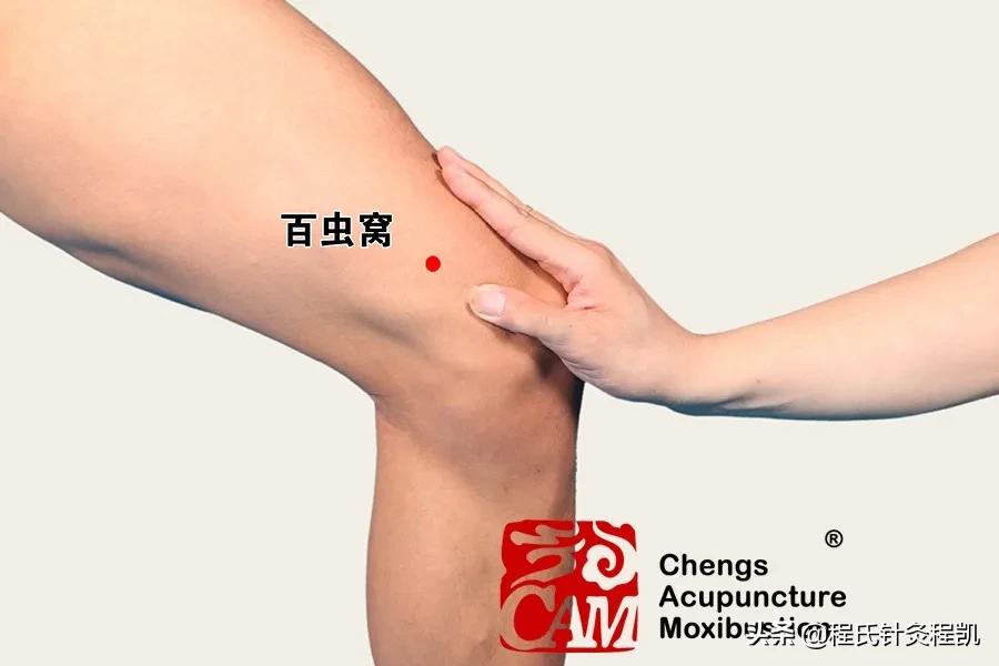 程凱養生說：皮膚幹又瘙癢，擦擦�止癢三角區�