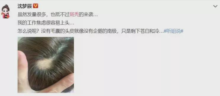 沈夢辰突然斑禿上熱搜！傳說中的"鬼剃頭"盯上年輕人，很多人還蒙在鼓里…