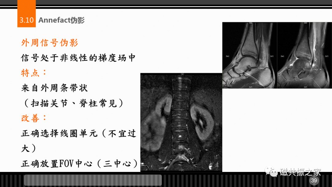 磁共振常见伪影及策略