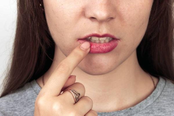 嘴唇上总是起泡，可能是这5个行为导致的，不能轻视