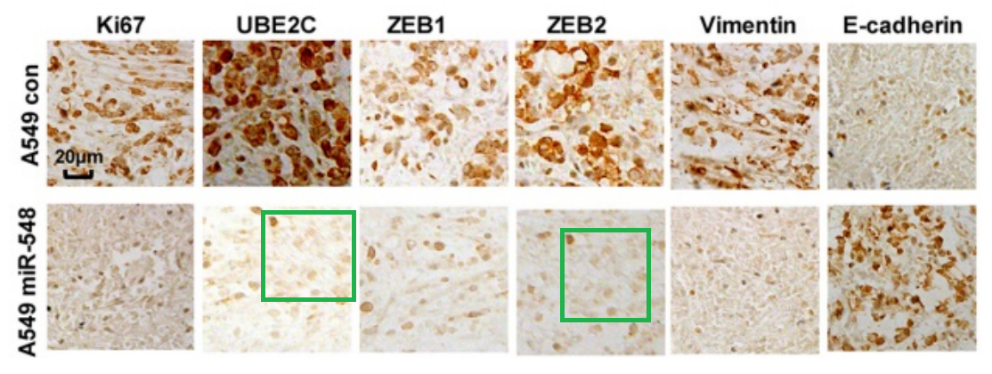 山东滨州医学院附属医院11篇SCI文章"挂榜"PubPeer