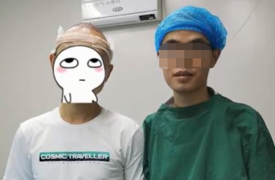 疯狂|24岁小伙疯狂健身后险些秃头 已有多人中招