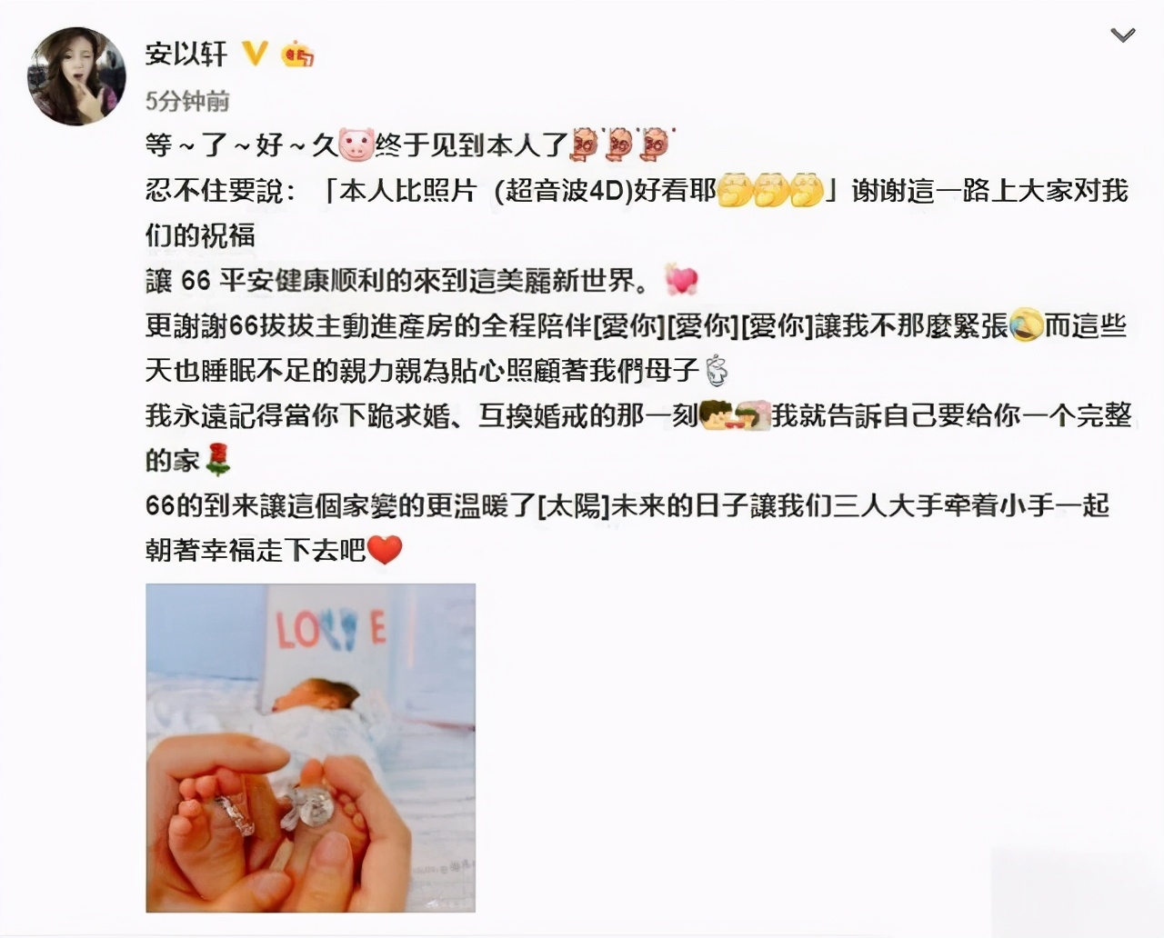 安以轩晒照官宣二胎生女喜讯，透露女儿小名叫娃宝长相比自己好看