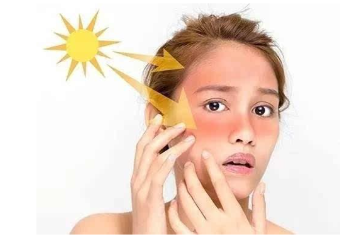 敏感肌如何护肤？避开误区、找对方法，才能事半功倍