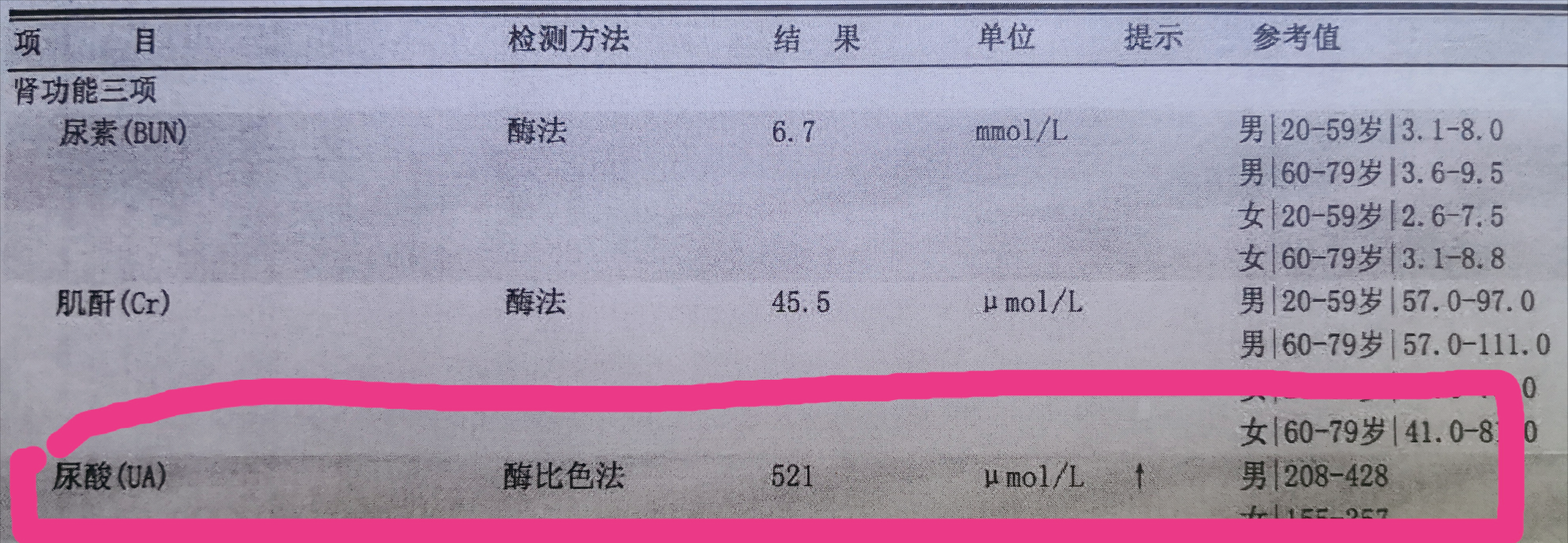 尿酸高，无痛风，吃药吗？中国、美国治疗方法不同！郭麒麟最该读