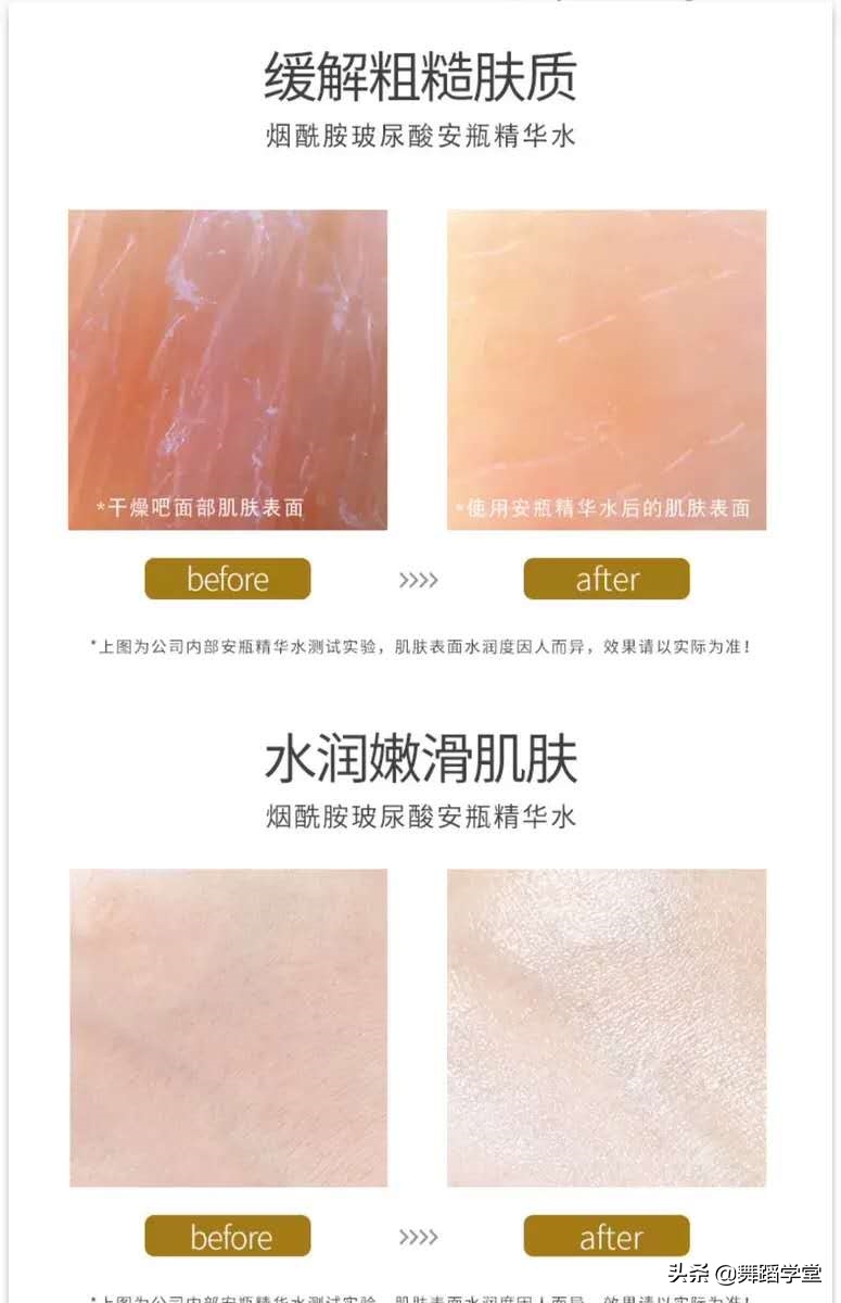 经常打玻尿酸的女人最后会变成啥样？五年美容师说出心里话