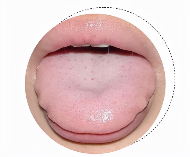 You must pay attention to these six tongue coatings iNEWS