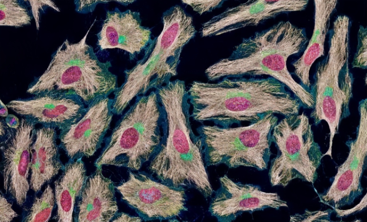 永生不死的癌細胞 至今已繁殖代 遍佈世界各地 趣探索一號 Mdeditor
