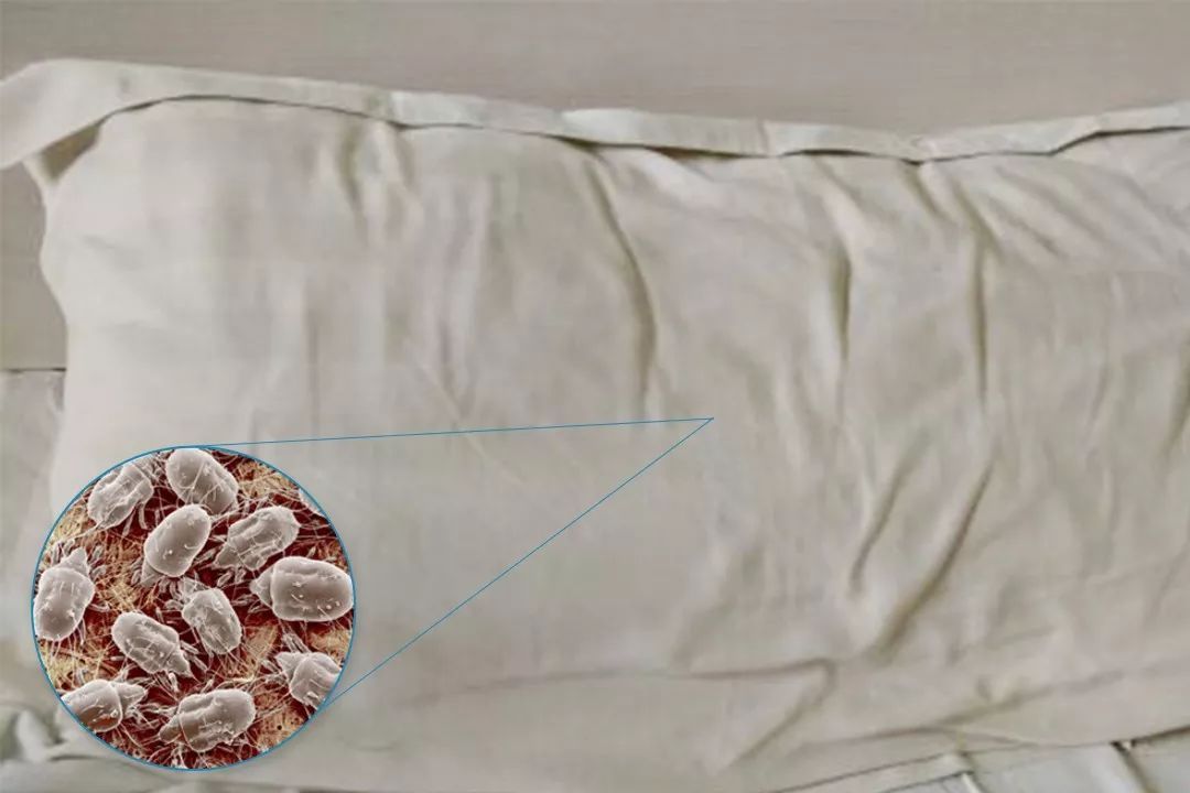 Does the quilt turn yellow and have a "peculiar smell" over time?Learn