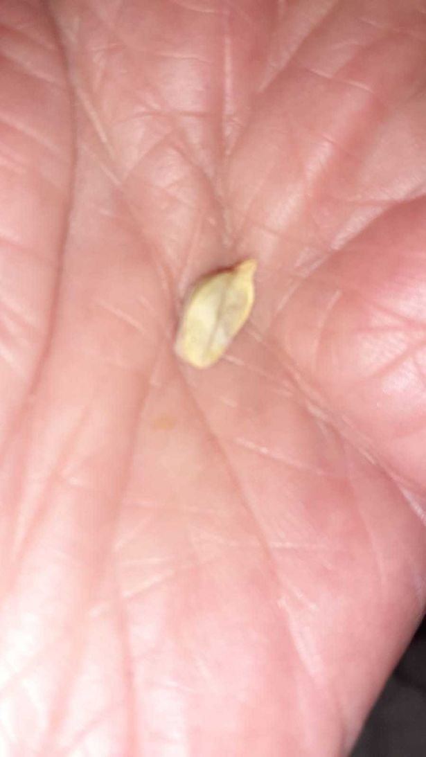 英国女子10岁时开始鼻塞，58年后她竟从鼻子里擤