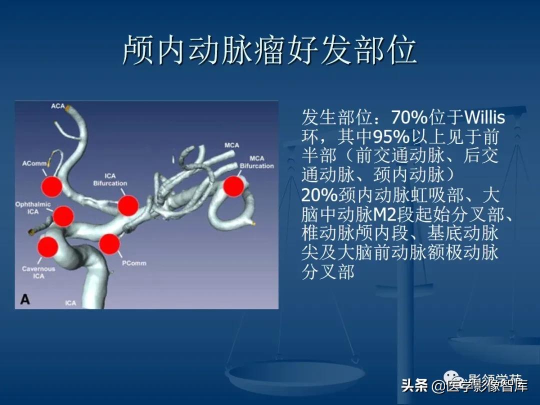 头颈部血管病变mra Cta和dsa影像表现 资讯咖