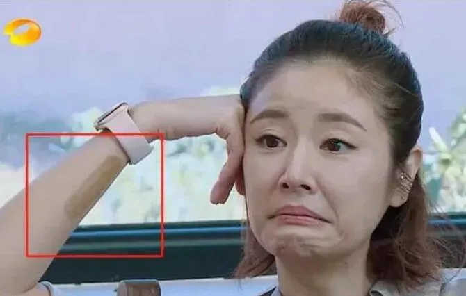 有纹身不能上节目！各位明星出奇招，吴尊的做