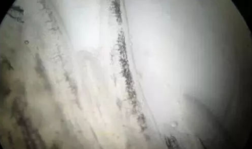 鱼类养成期和苗种期鳃霉病的防治