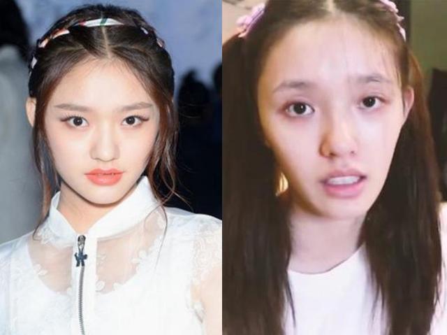 悲剧！他们瘦了反而更难看了？