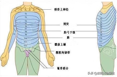 半身麻醉是一种怎样的体验