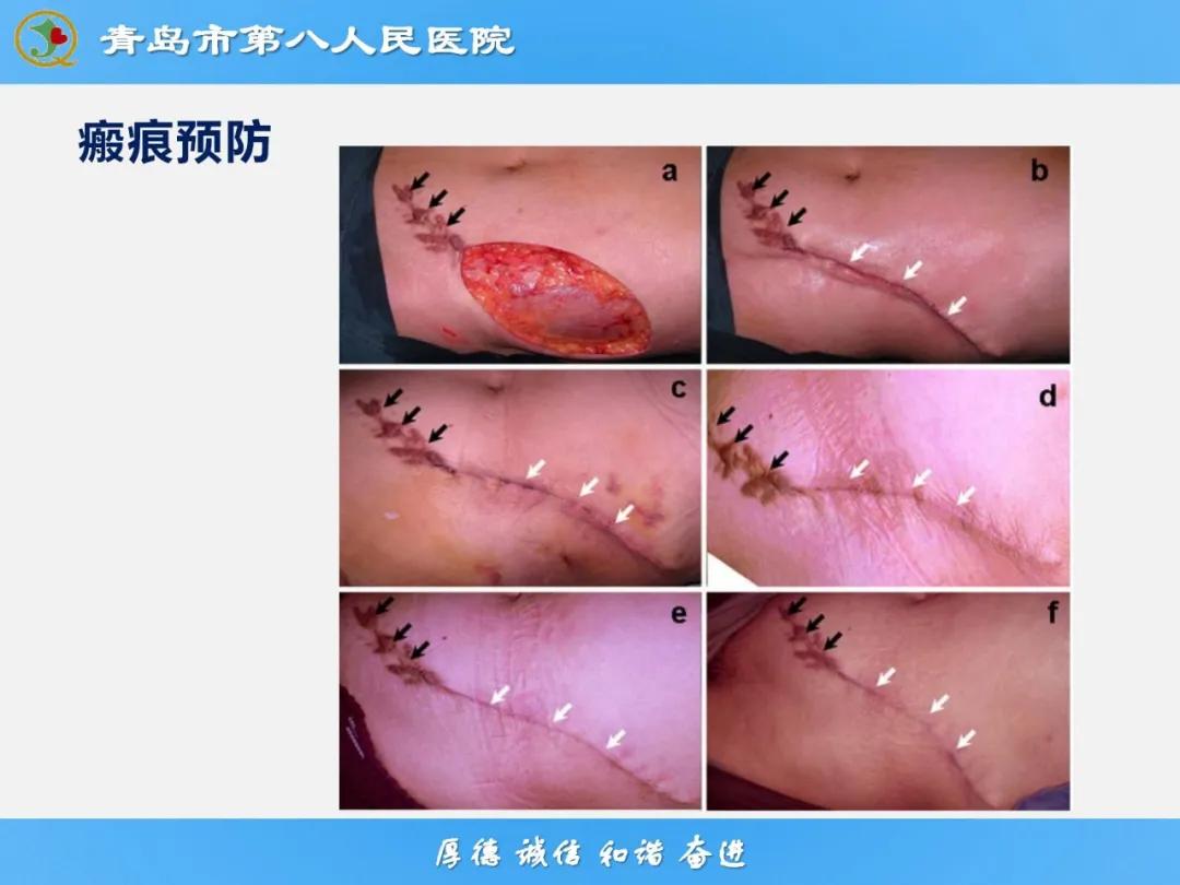 健康科普大赛获奖作品展示⑭丨肉毒毒素微整注射
