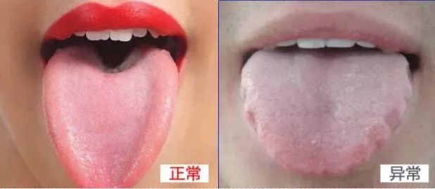 体内湿邪重，3个部位会发出"信号"，做好4件事，逼出体内湿气