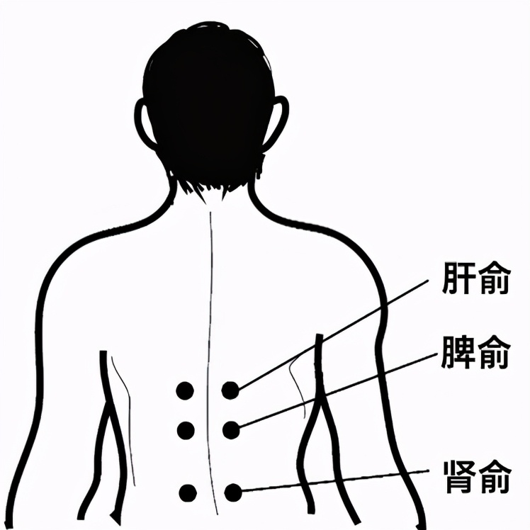 冬病夏治风湿病科三伏贴贴敷指南